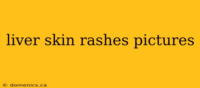 liver skin rashes pictures