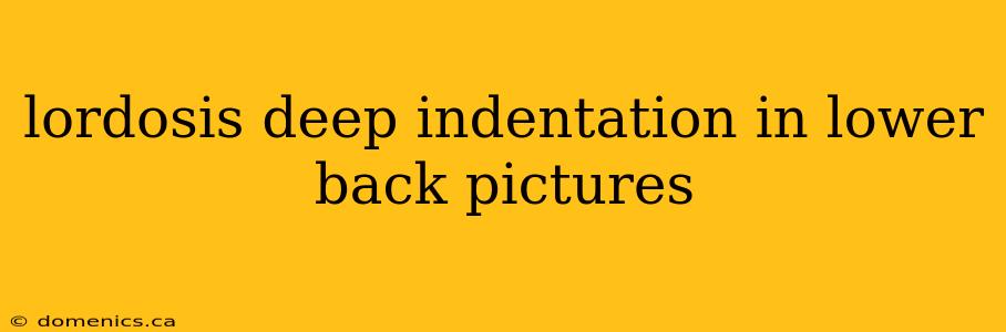 lordosis deep indentation in lower back pictures