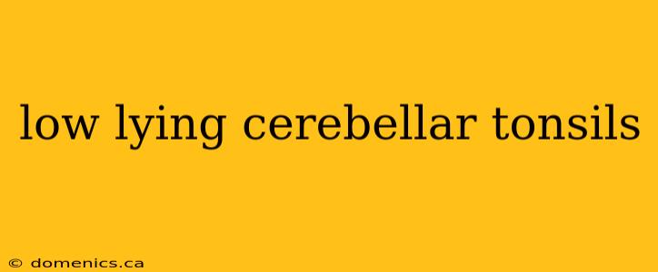 low lying cerebellar tonsils