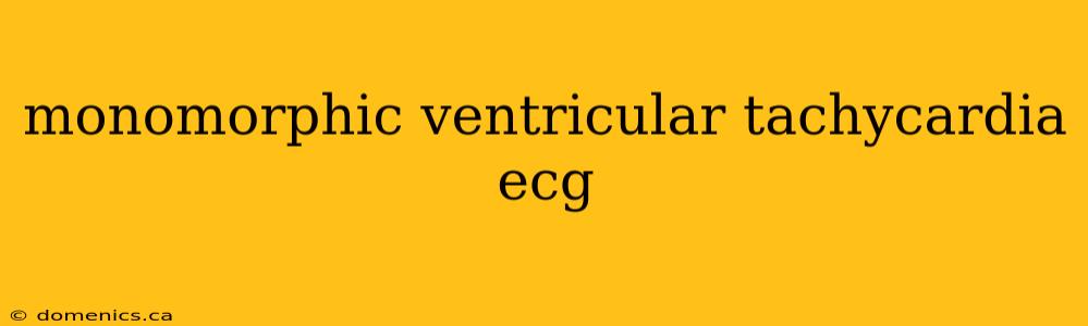 monomorphic ventricular tachycardia ecg