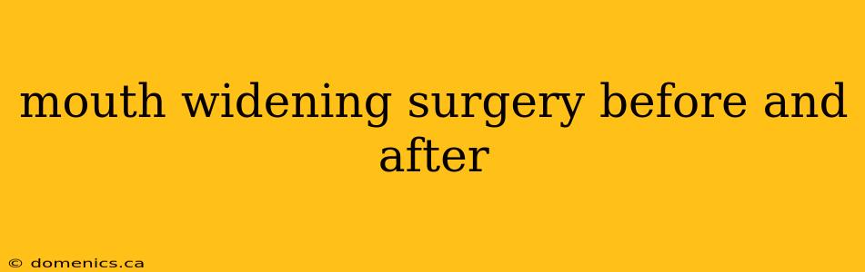 mouth widening surgery before and after