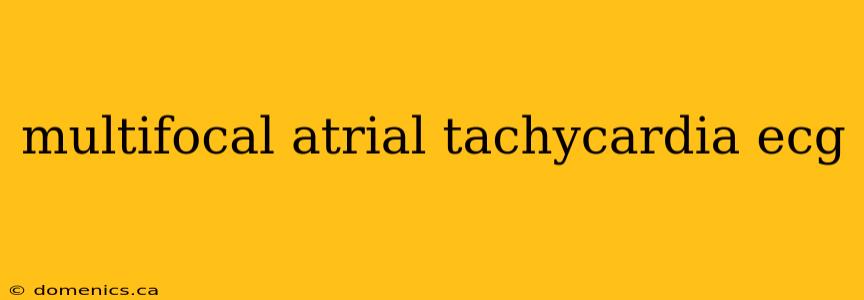 multifocal atrial tachycardia ecg