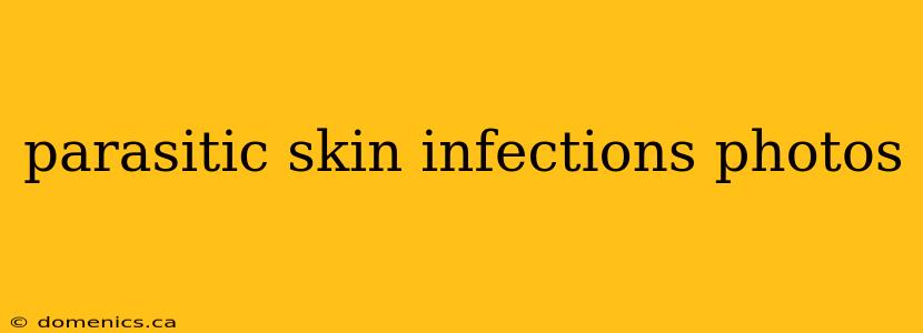 parasitic skin infections photos