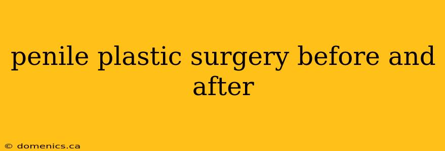 penile plastic surgery before and after