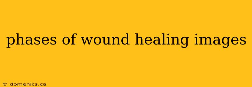 phases of wound healing images