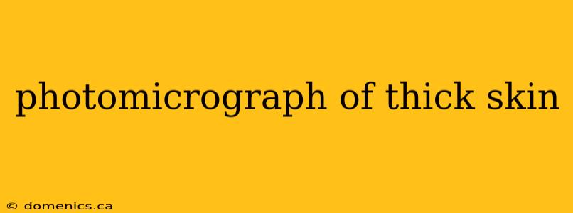 photomicrograph of thick skin