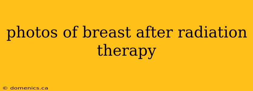 photos of breast after radiation therapy