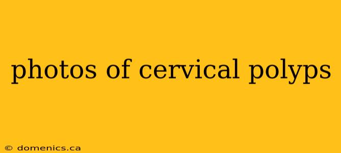 photos of cervical polyps