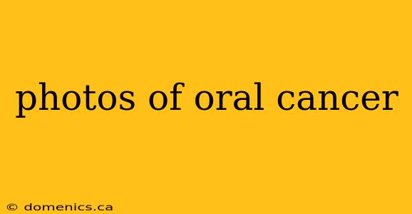 photos of oral cancer