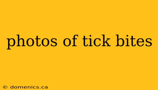 photos of tick bites