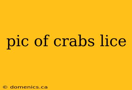 pic of crabs lice