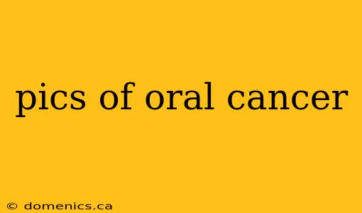 pics of oral cancer