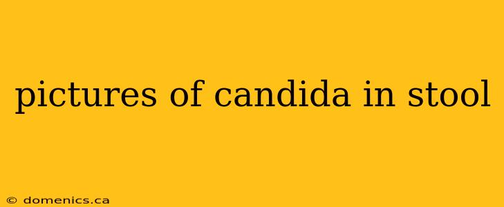 pictures of candida in stool