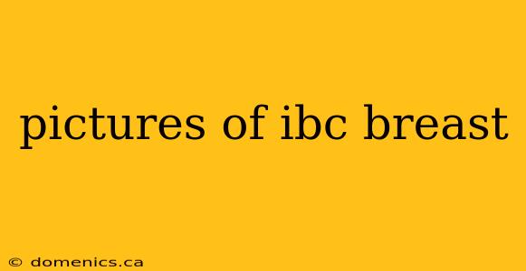 pictures of ibc breast