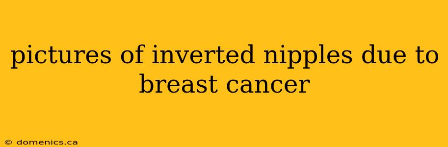 pictures of inverted nipples due to breast cancer