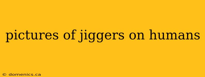 pictures of jiggers on humans