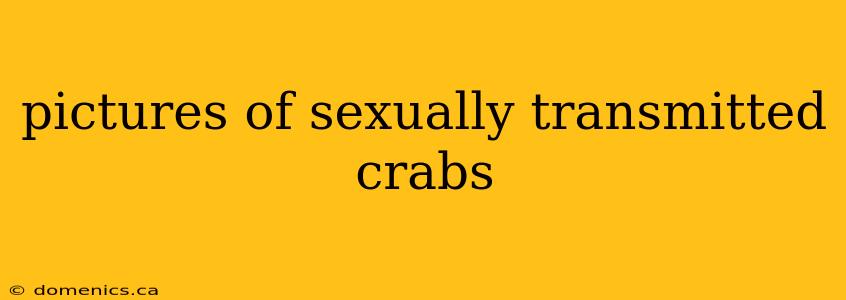 pictures of sexually transmitted crabs