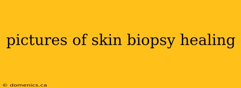 pictures of skin biopsy healing