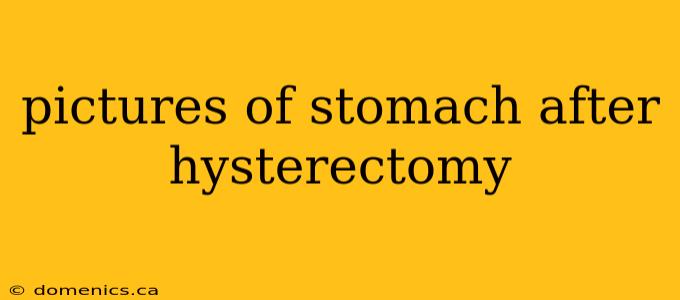 pictures of stomach after hysterectomy