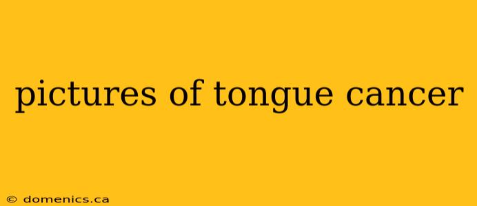 pictures of tongue cancer