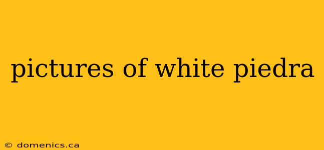 pictures of white piedra