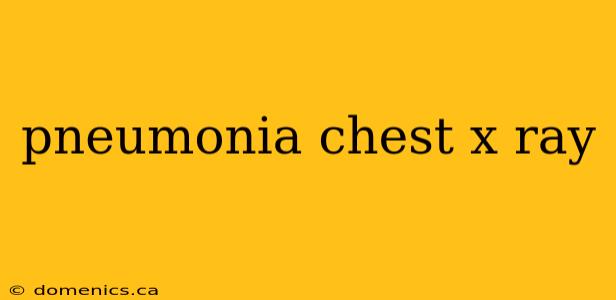 pneumonia chest x ray