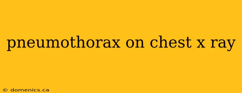 pneumothorax on chest x ray