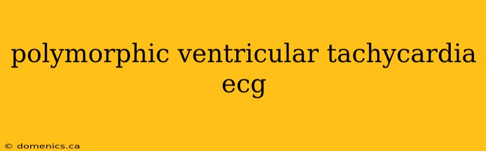 polymorphic ventricular tachycardia ecg