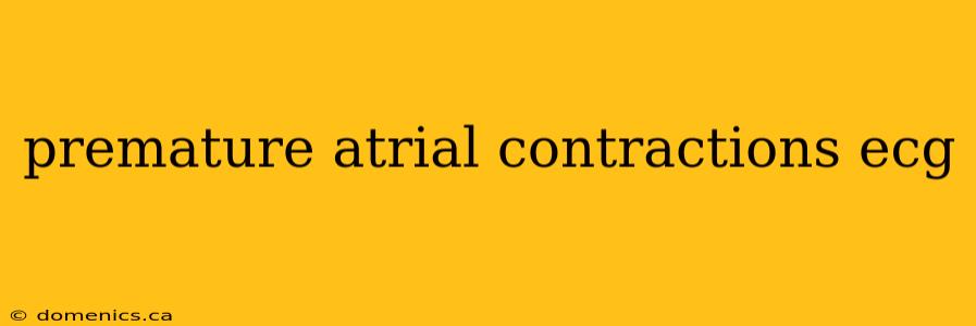 premature atrial contractions ecg