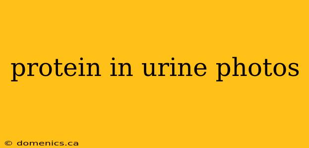 protein in urine photos