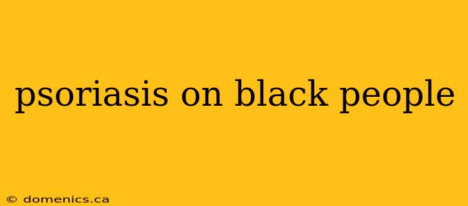 psoriasis on black people