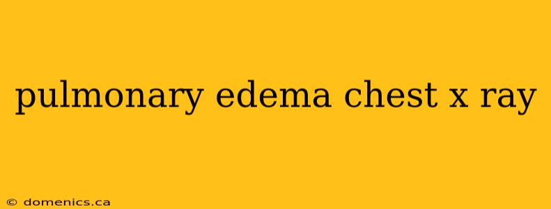 pulmonary edema chest x ray
