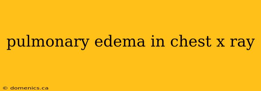 pulmonary edema in chest x ray