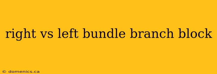 right vs left bundle branch block