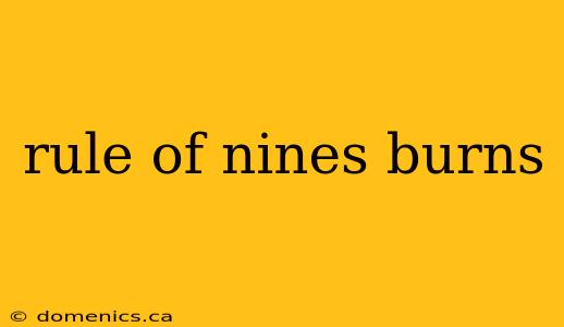 rule of nines burns