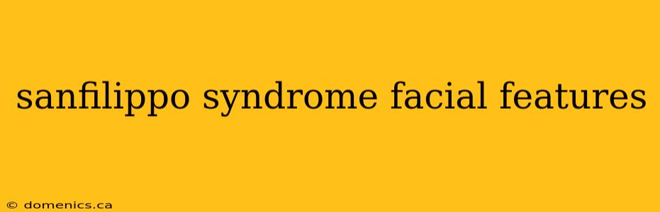 sanfilippo syndrome facial features
