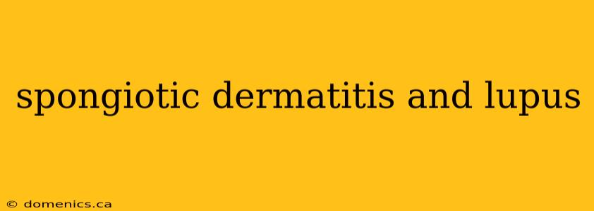 spongiotic dermatitis and lupus