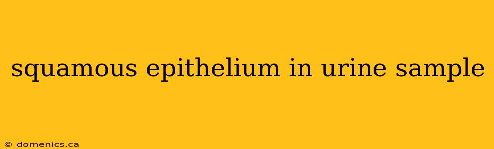 squamous epithelium in urine sample