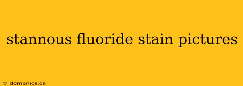 stannous fluoride stain pictures