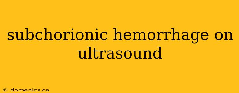 subchorionic hemorrhage on ultrasound