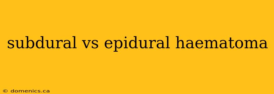 subdural vs epidural haematoma