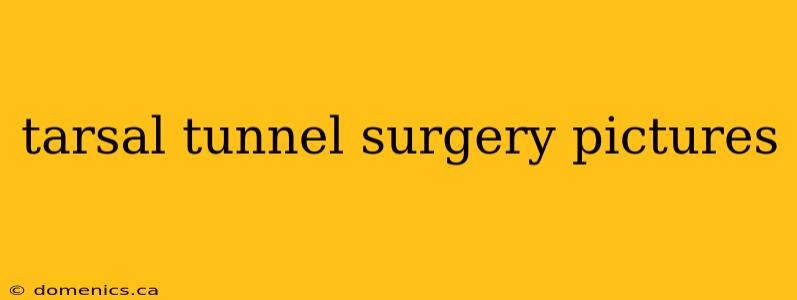 tarsal tunnel surgery pictures