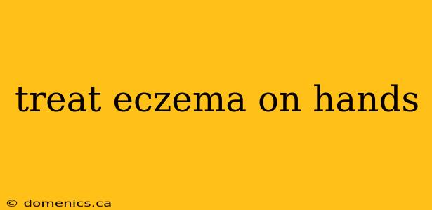 treat eczema on hands