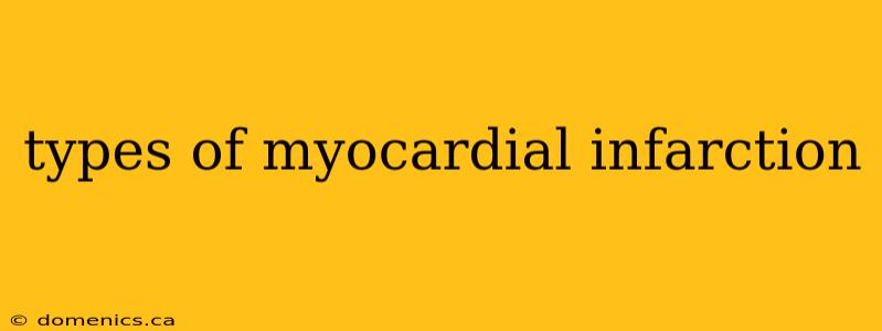 types of myocardial infarction