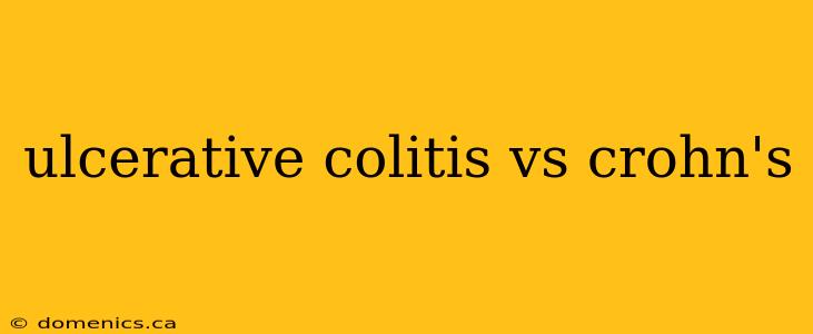 ulcerative colitis vs crohn's