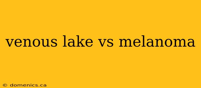 venous lake vs melanoma