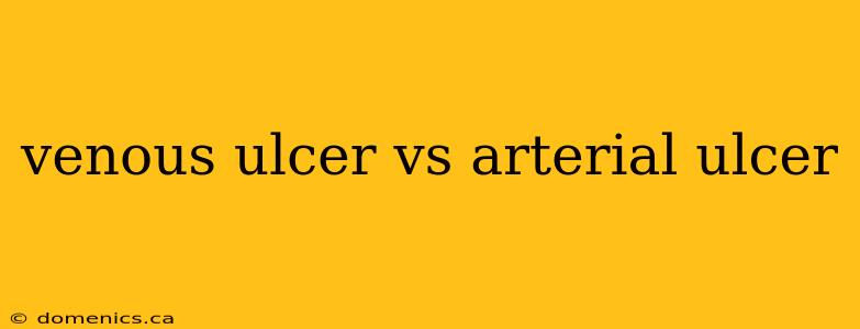 venous ulcer vs arterial ulcer