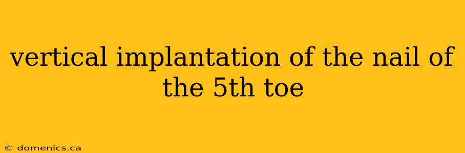 vertical implantation of the nail of the 5th toe