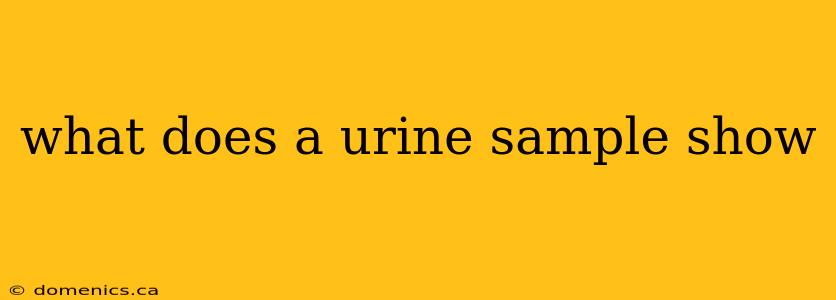 what does a urine sample show