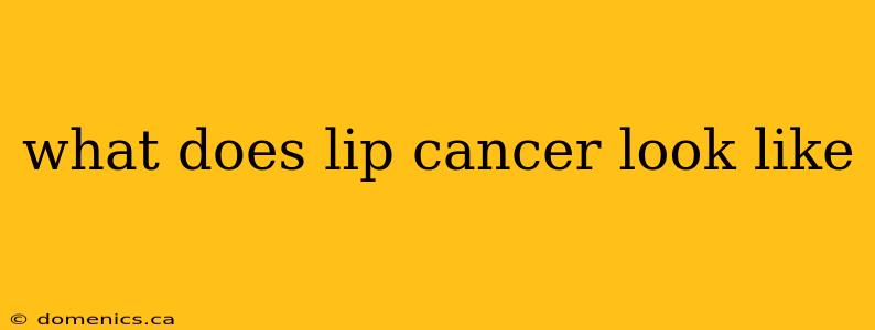 what does lip cancer look like